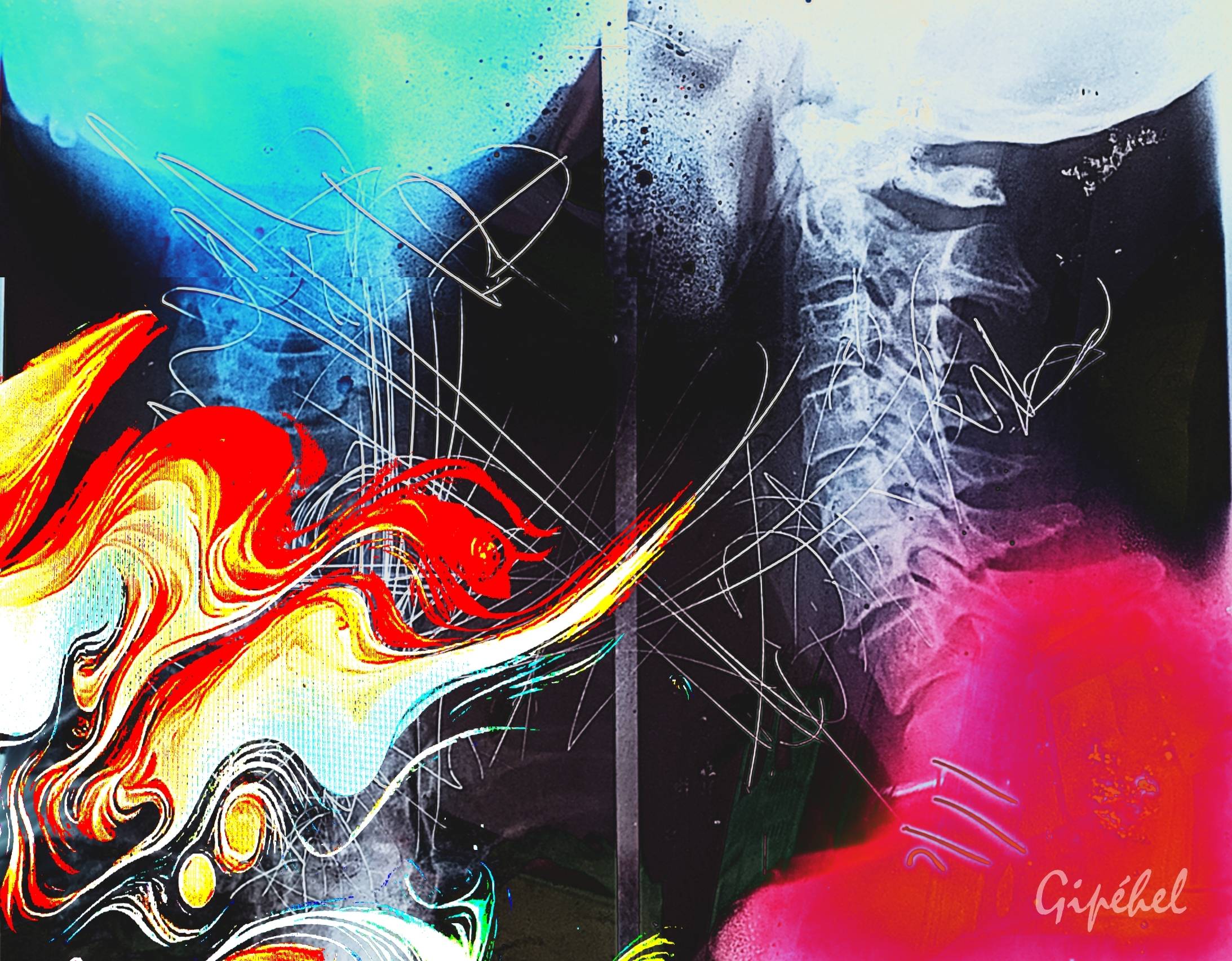 Colonne vertébrale. 