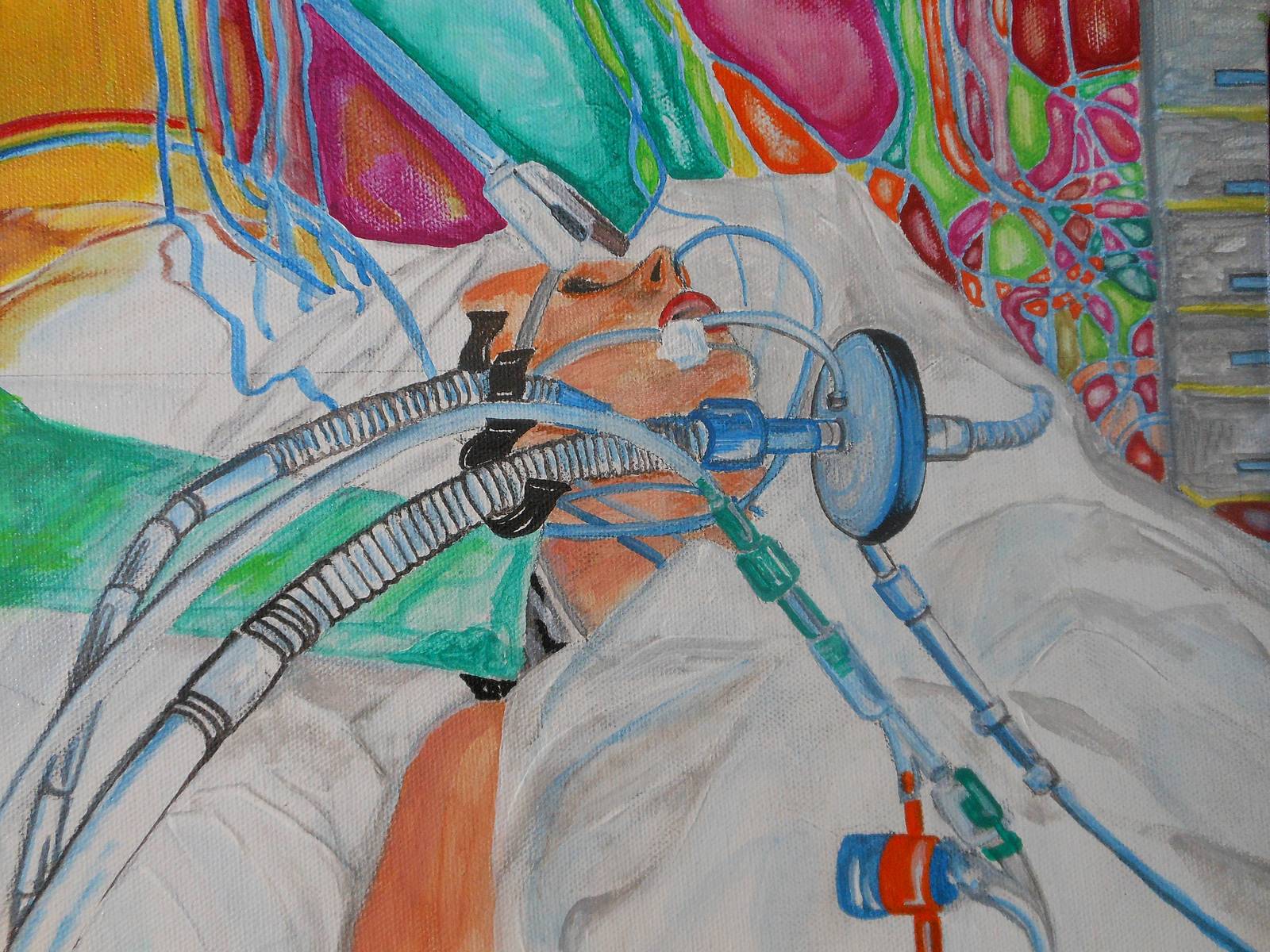 Méningite à méningocoque b. 